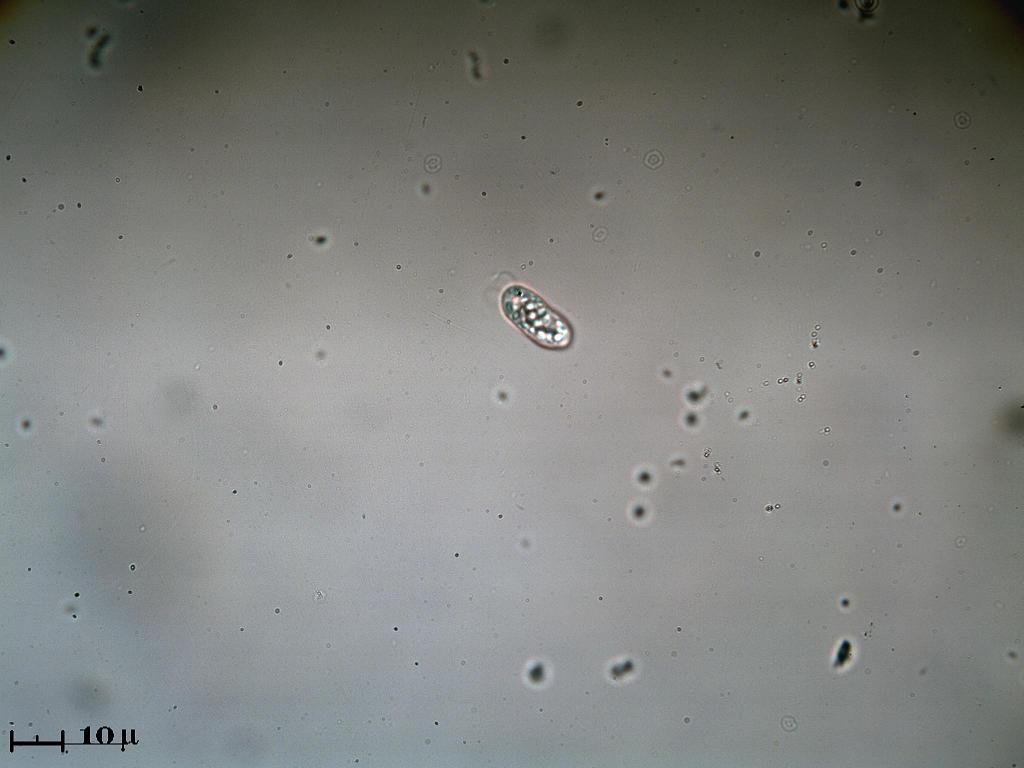 Ex Achromatium
