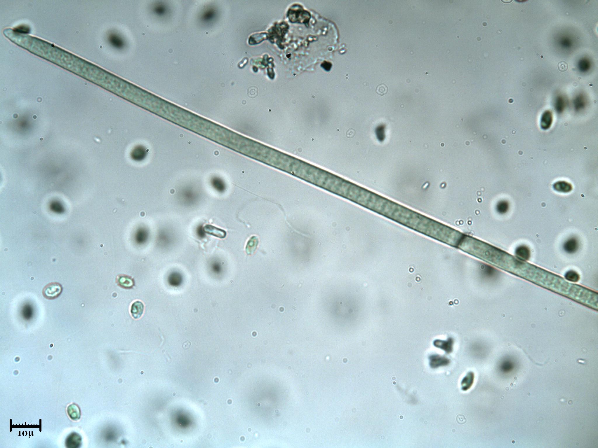 Cyanobatterio