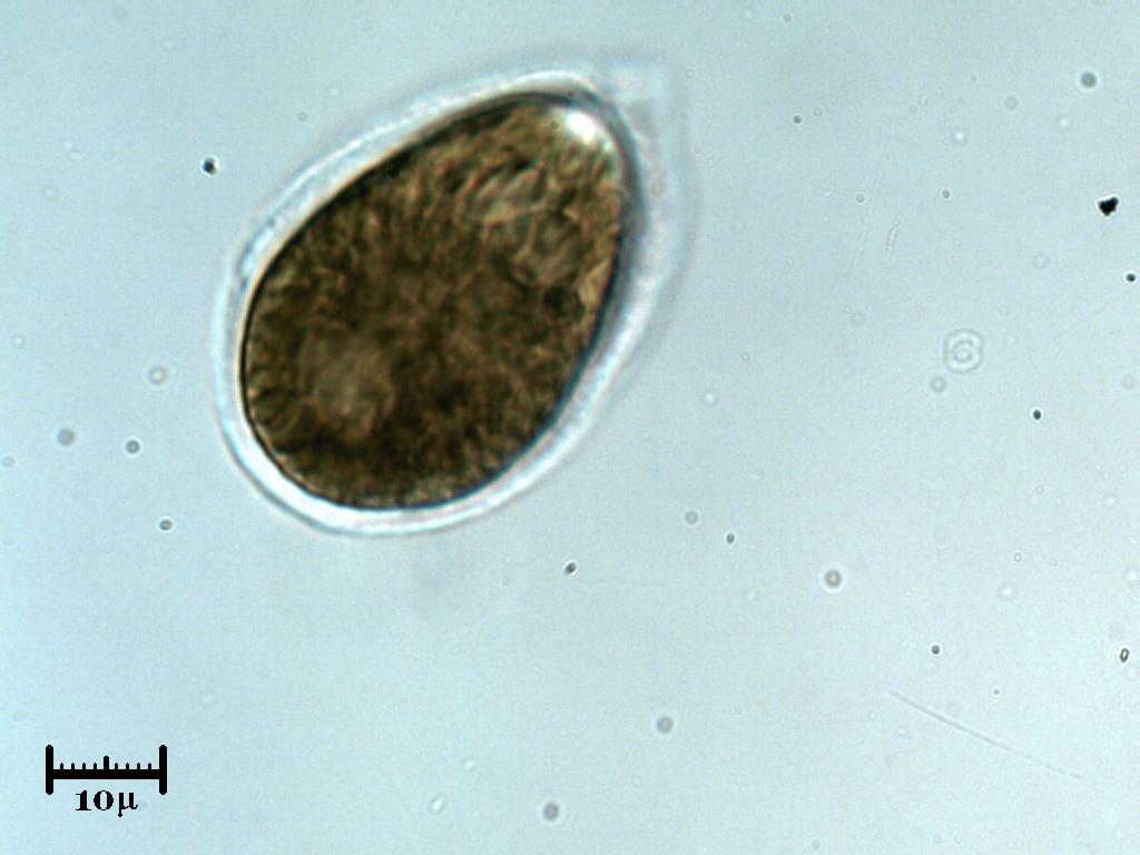 Sembra un''alga ma si muove come un ciliato