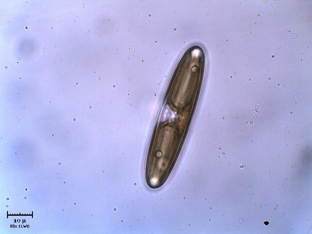 Diatoma?