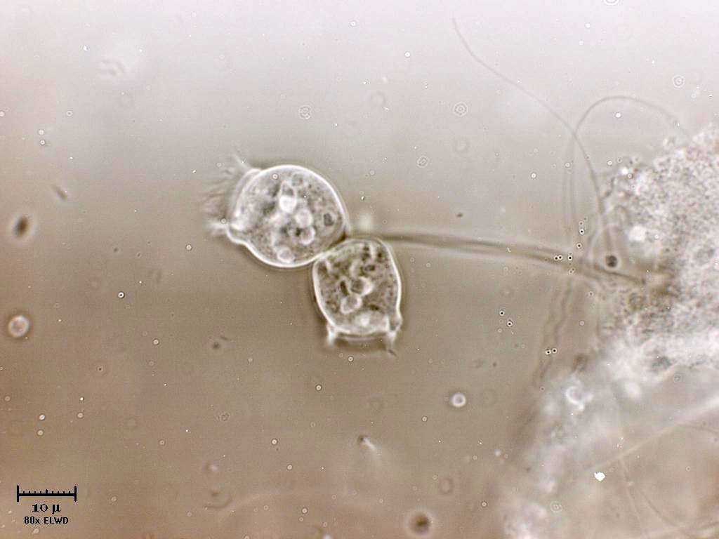 Vorticelle a Ganzirri