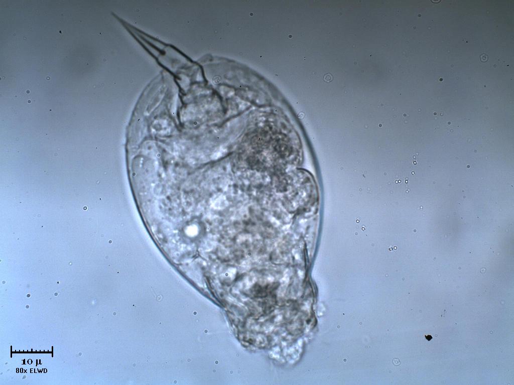 Rotifero. Abbiate pazienza.