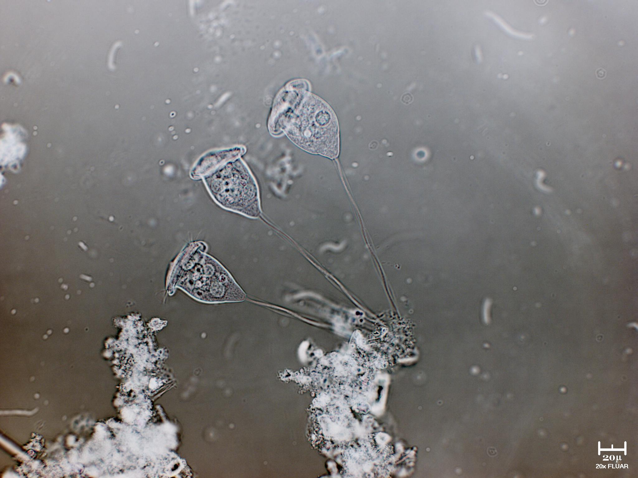 ESCOCAT - IL RITORNO  [ Vorticella sp. ]