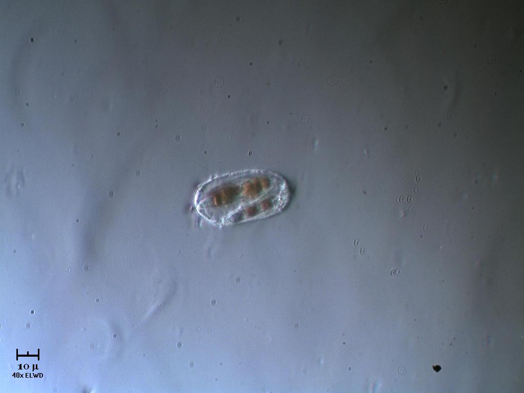 Due diatomee incapsulate?