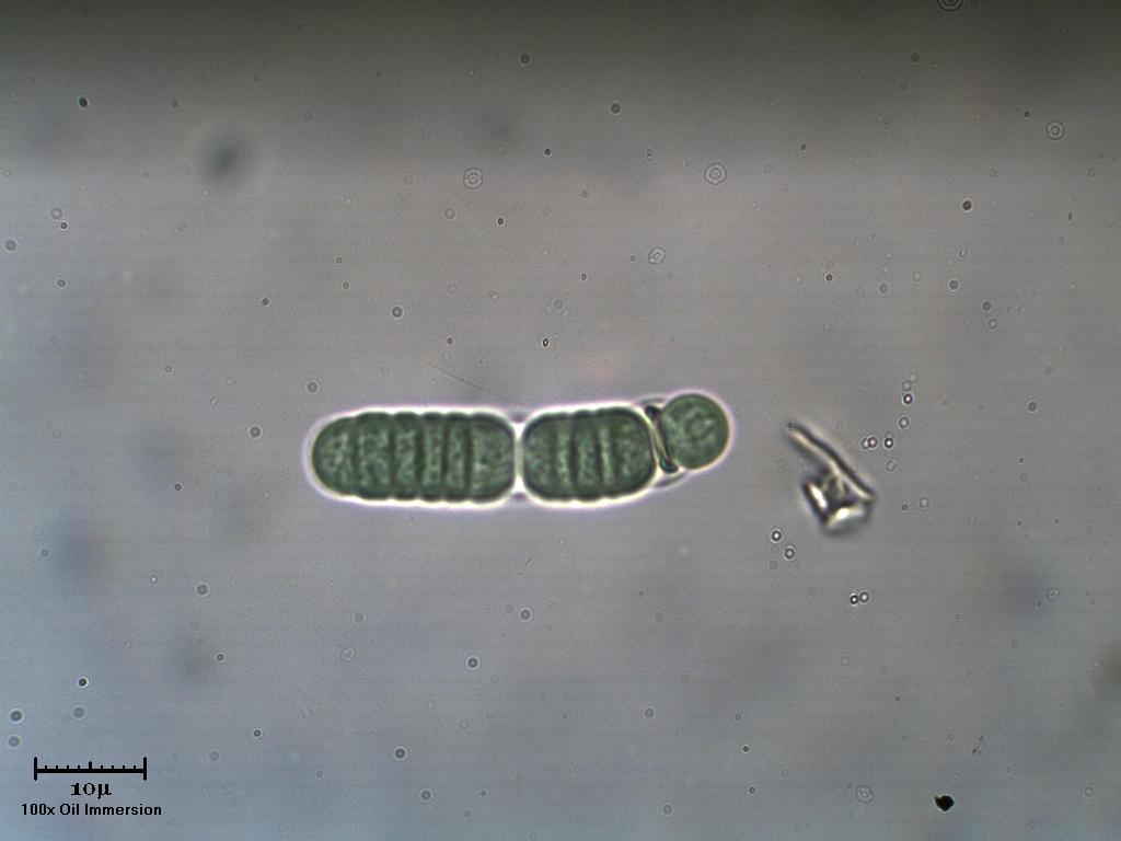 Cianobatterio (Oscillatoria?)