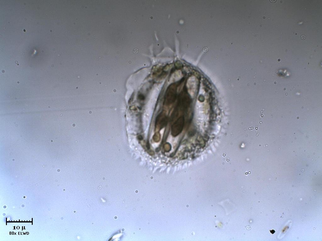 Amoeba 2