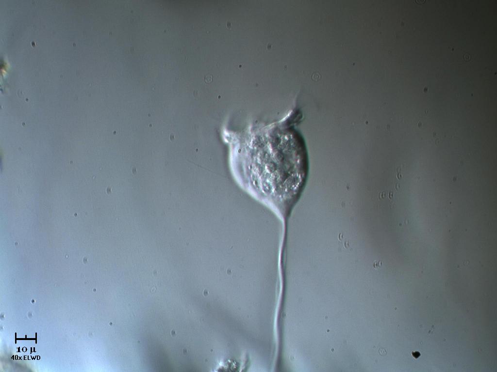 Ah si? E perch io no Vorticella sp?