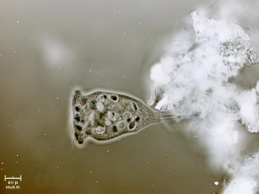 Ah si? E perch io no Vorticella sp?
