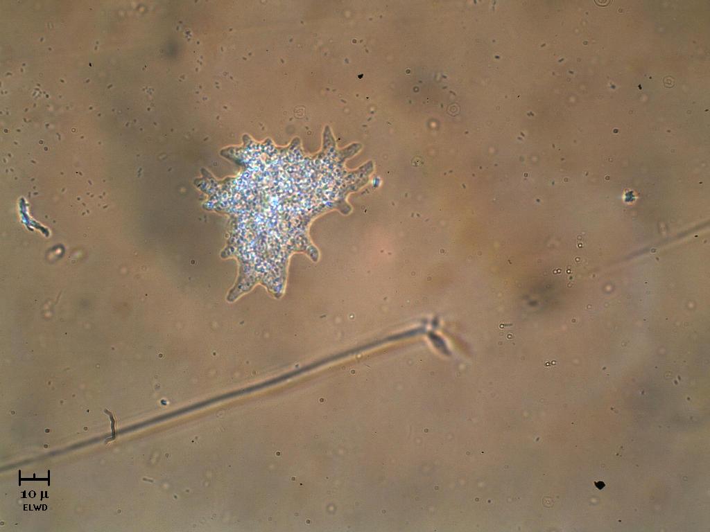 Amoeba in luce incidente