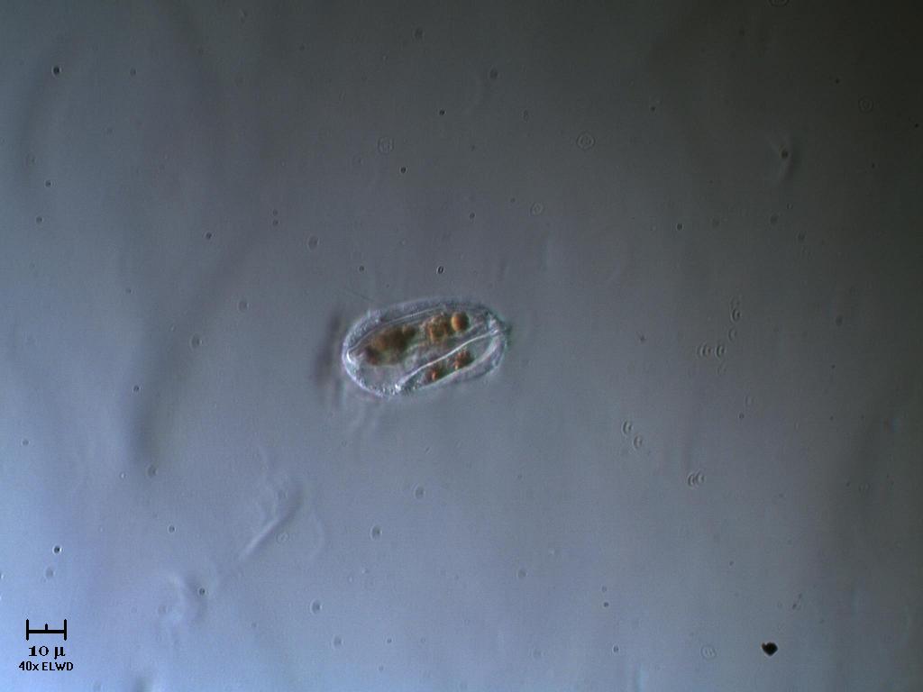 Due diatomee incapsulate?