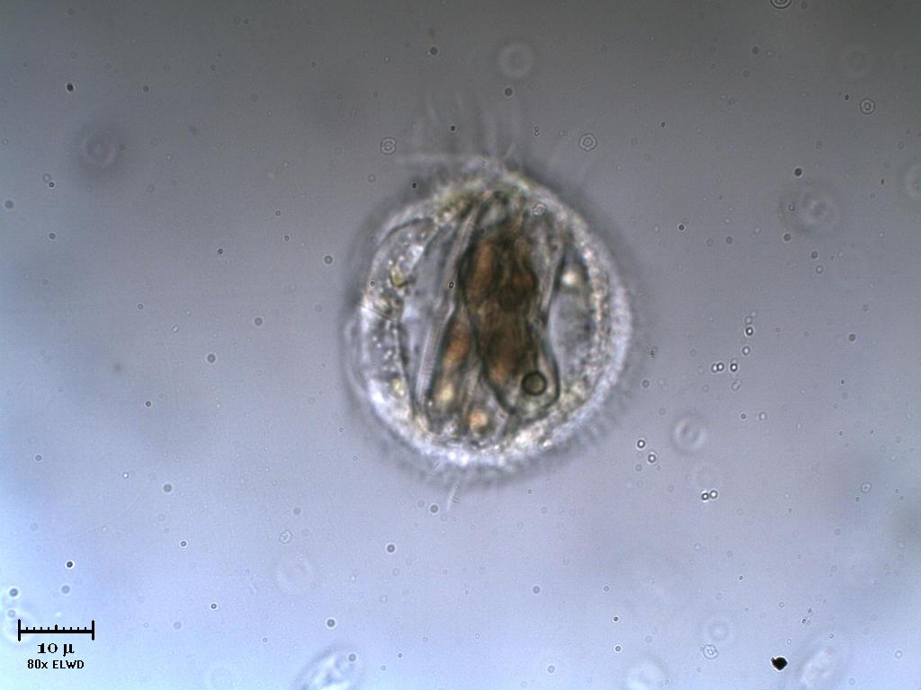 Amoeba 2