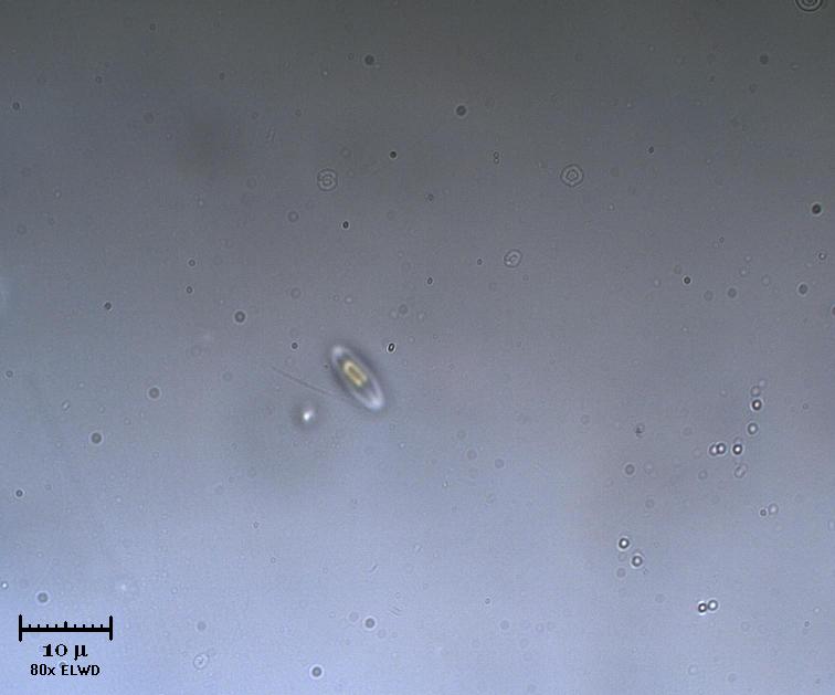 Diatomea alogena