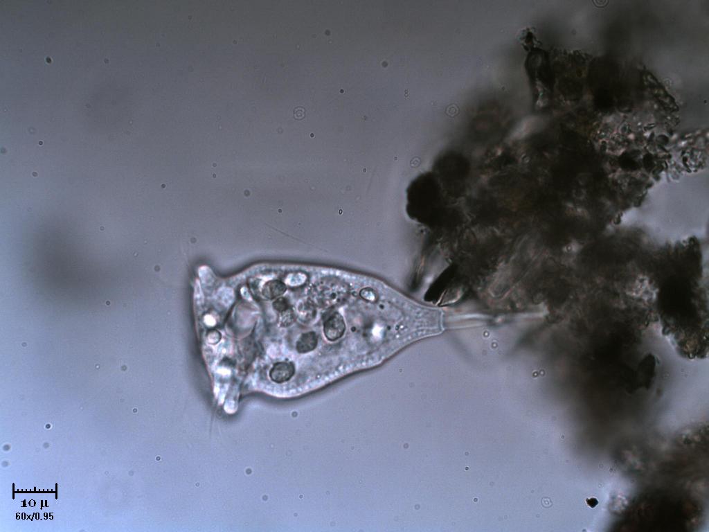 Ah si? E perch io no Vorticella sp?