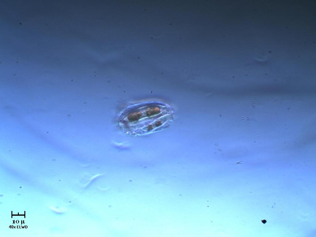 Due diatomee incapsulate?