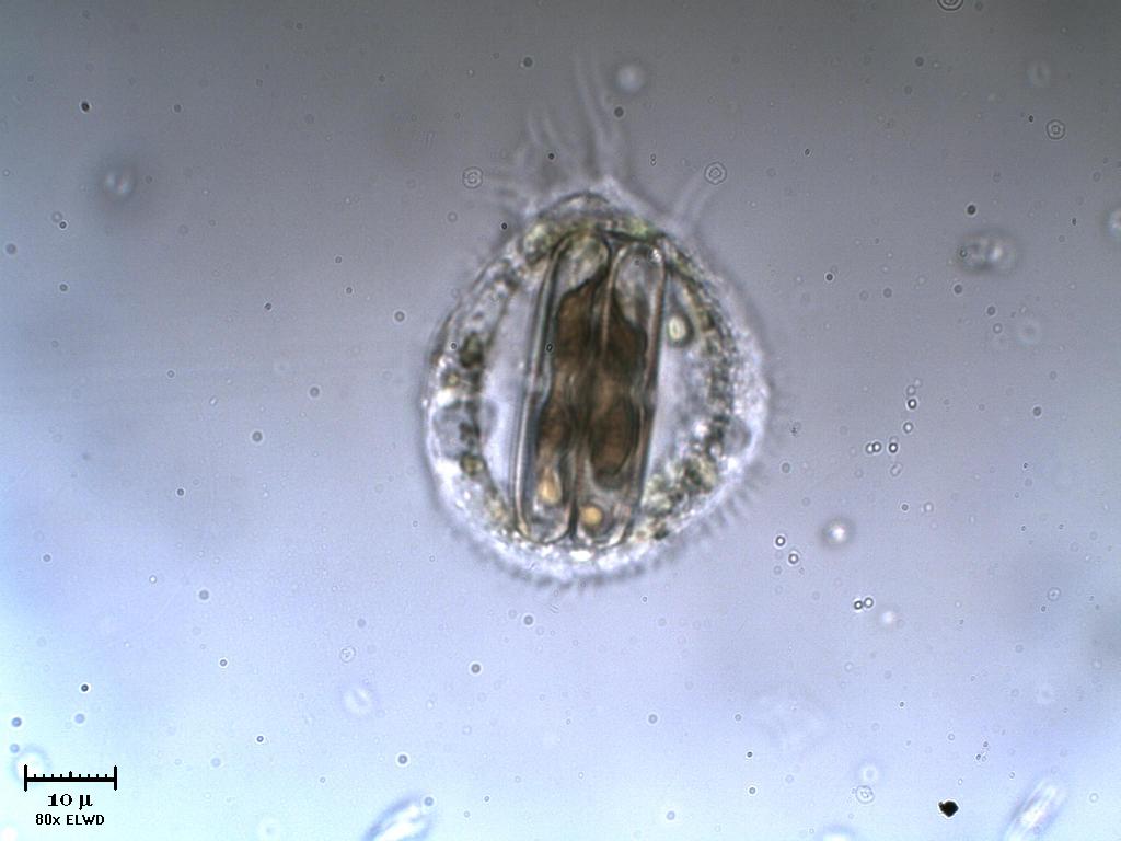 Amoeba 2