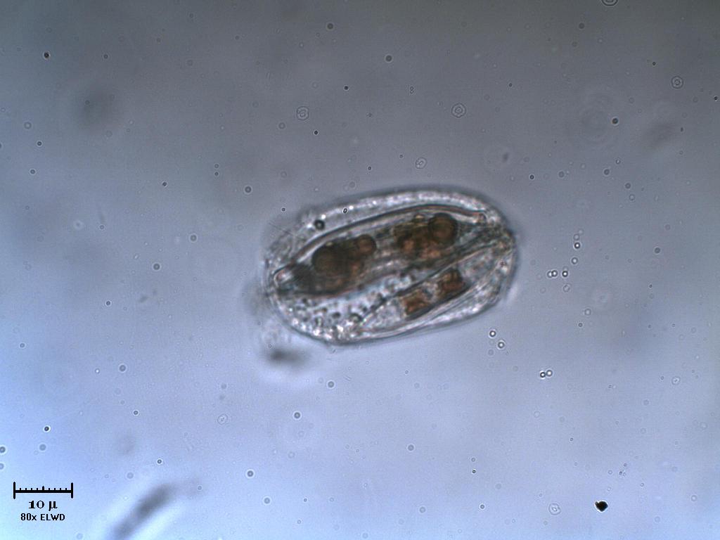 Due diatomee incapsulate?