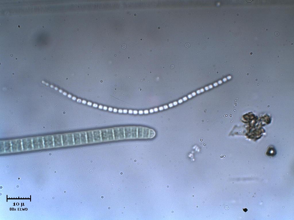 Scontro fra cyanobatteri