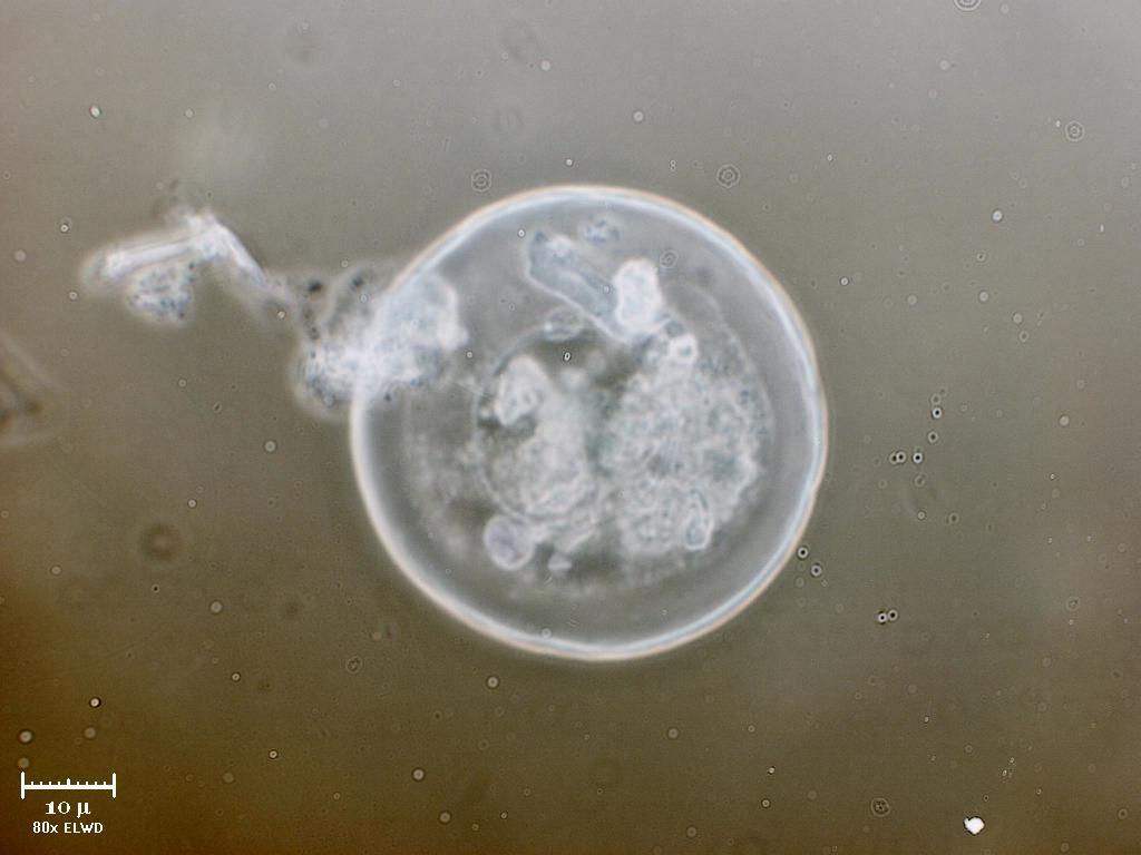 Tecasenzamoeba