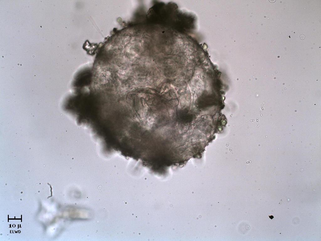 T... TE... TECAMEBA!