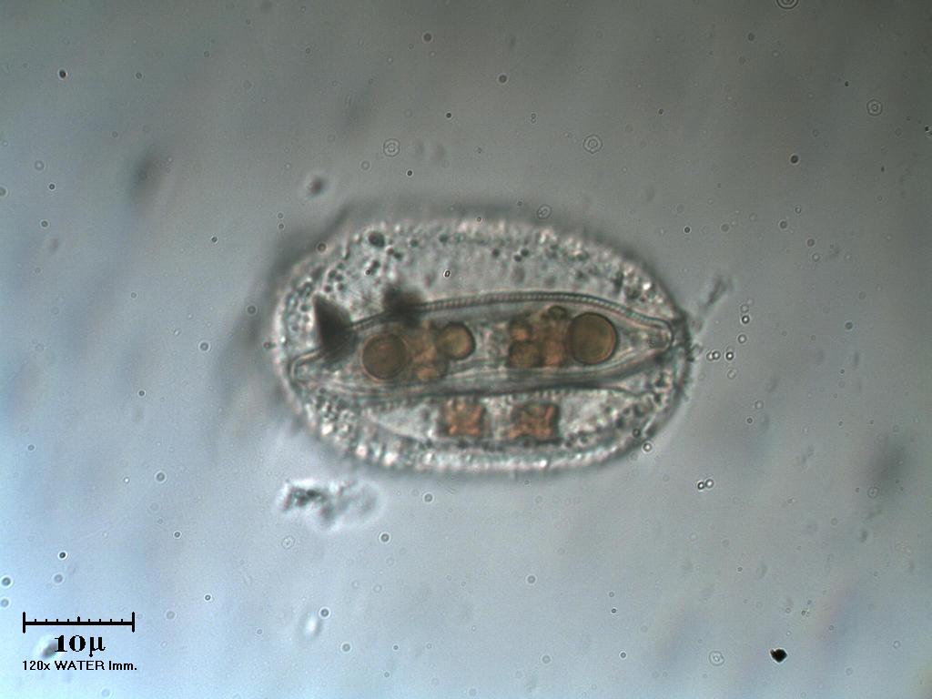 Due diatomee incapsulate?
