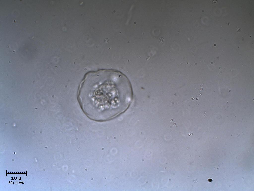 Che bello 1 altra Vitreochlamys!