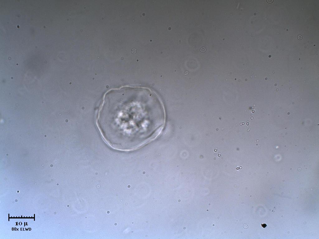 Che bello 1 altra Vitreochlamys!