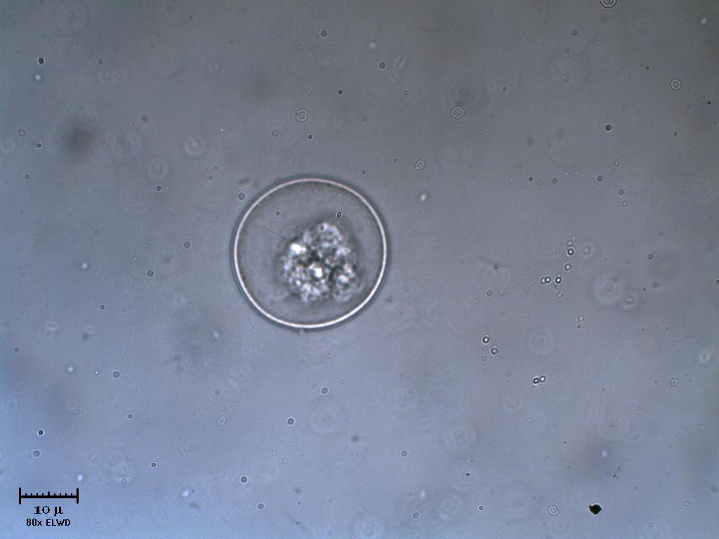 Che bello 1 altra Vitreochlamys!