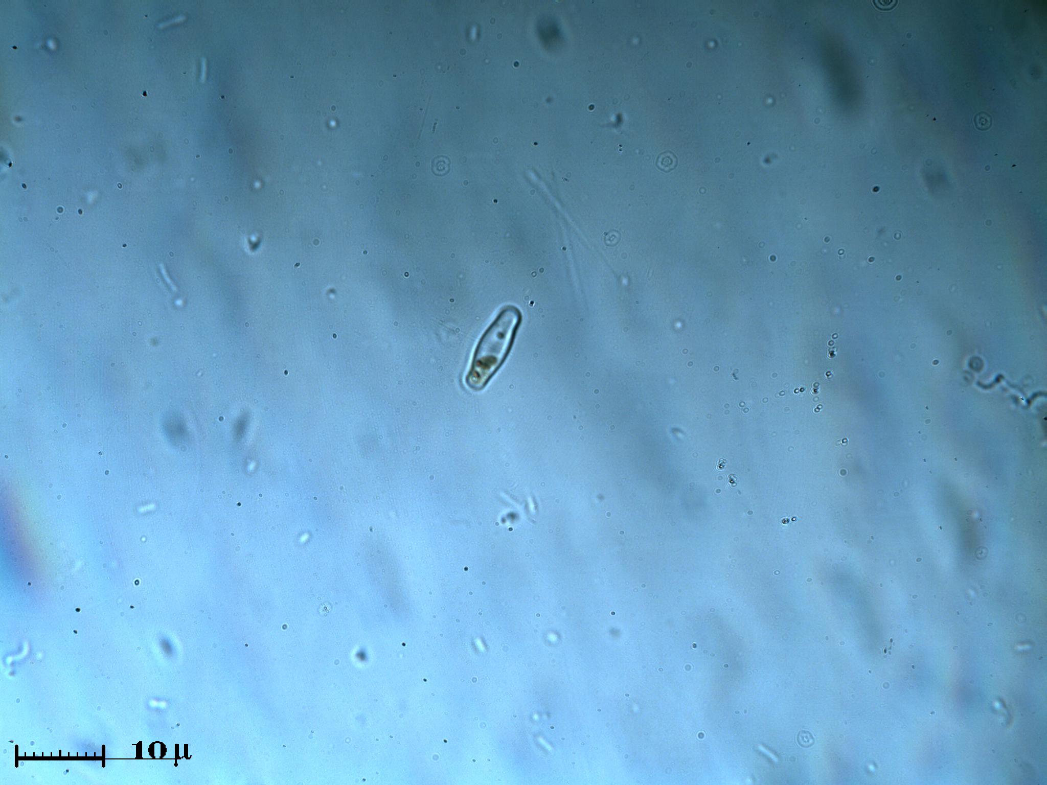 Miniamoeba e miniminidiatomea