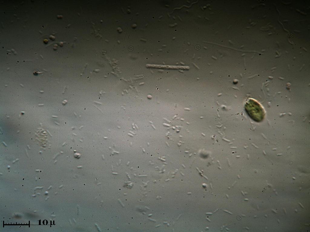Cyanobacterio?