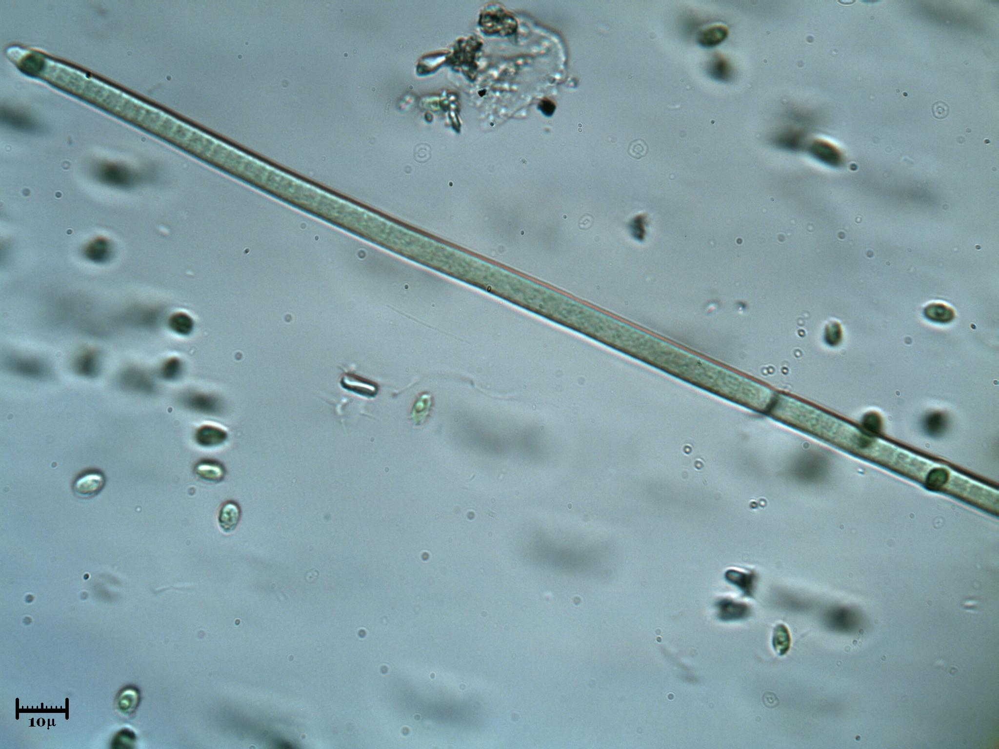 Cyanobatterio