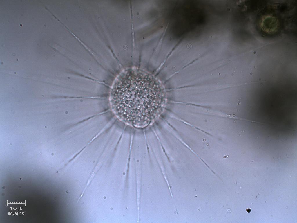 Heliozoo inta & extra focale [ Actinophrys sol ]