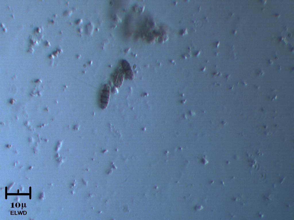 Spore