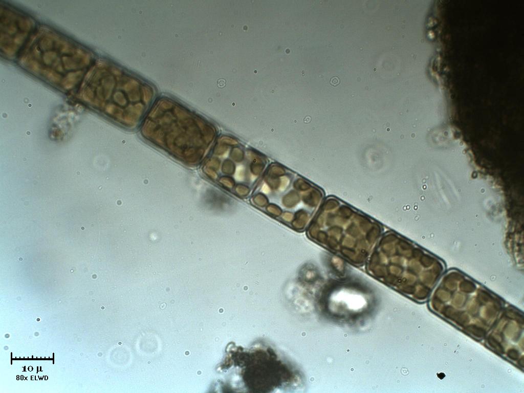 Melosira