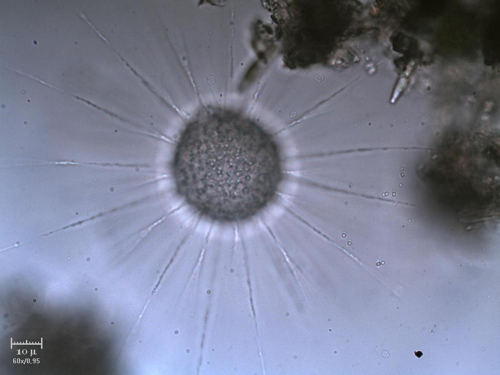 Heliozoo inta & extra focale [ Actinophrys sol ]