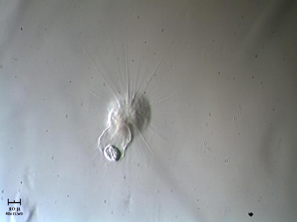 Il pasto dell''Heliozoo