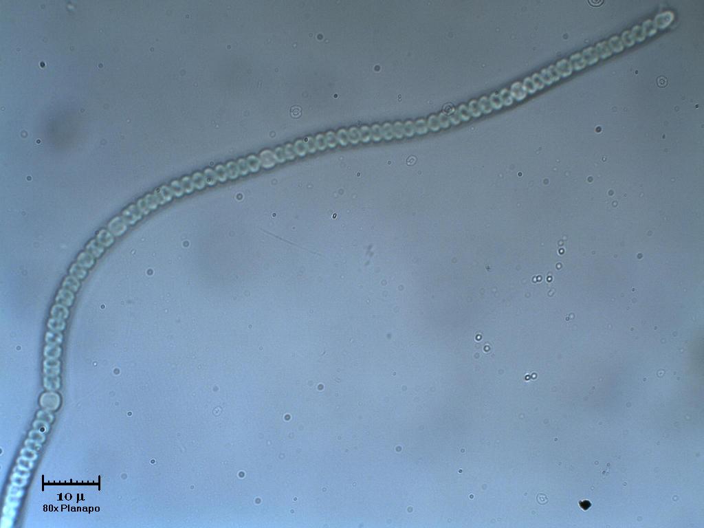Nodularia
