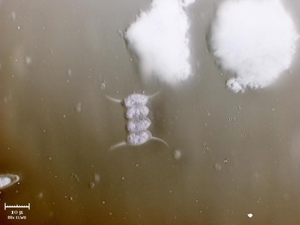 Scenedesmus diffratto e reverse