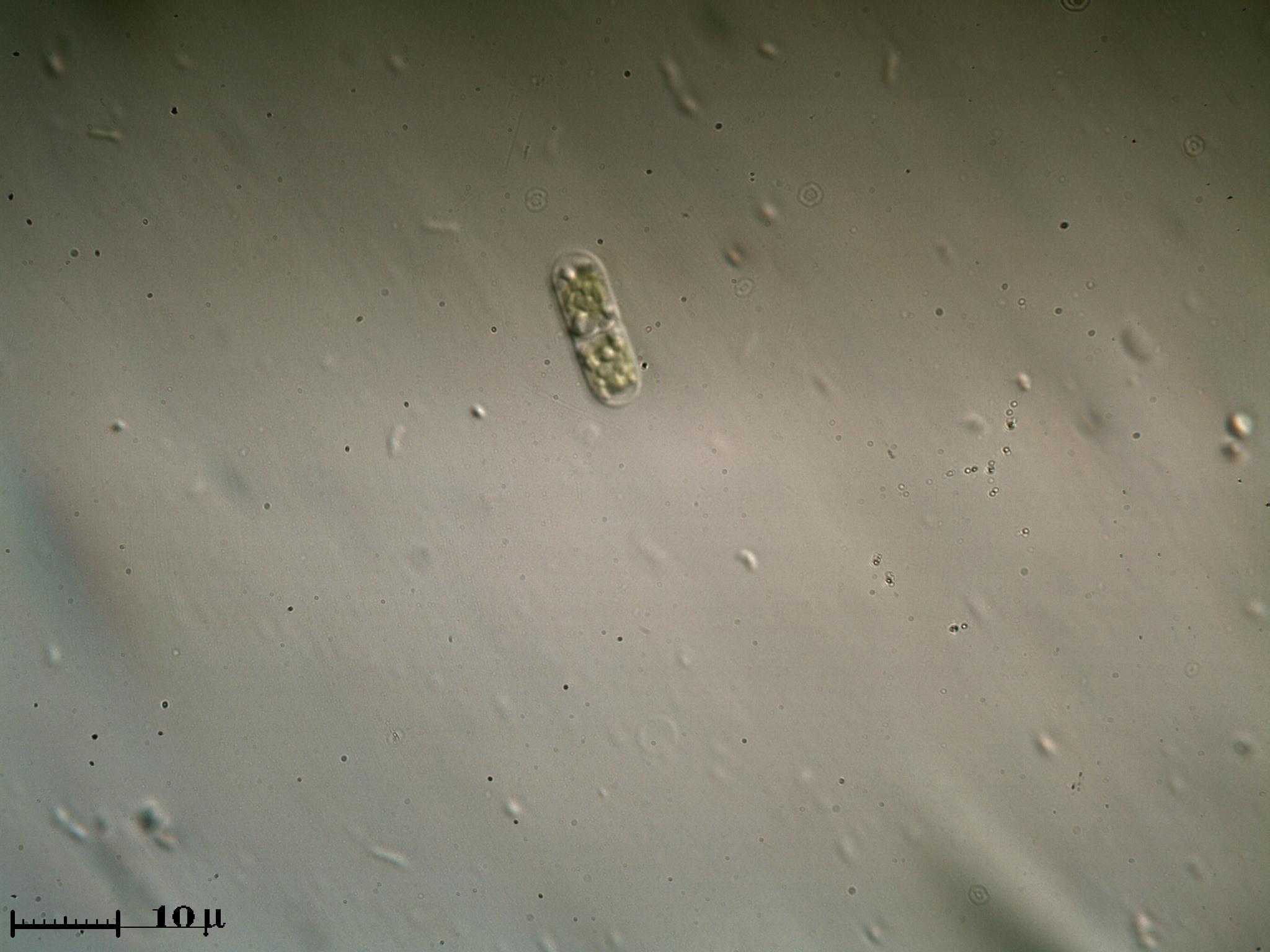 Cyanobatterio o Achromatium?