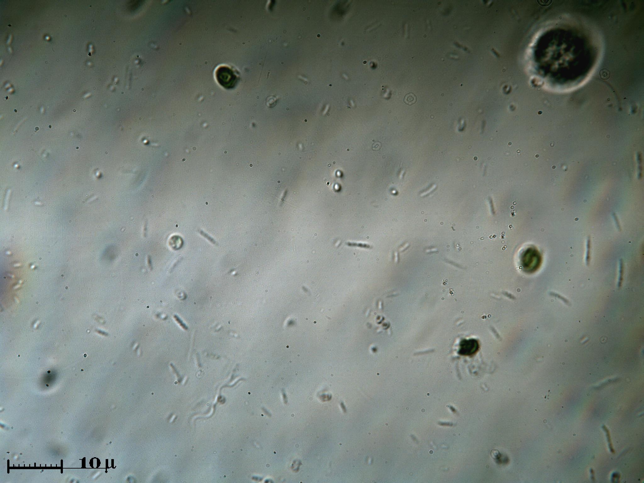 Strana coppia