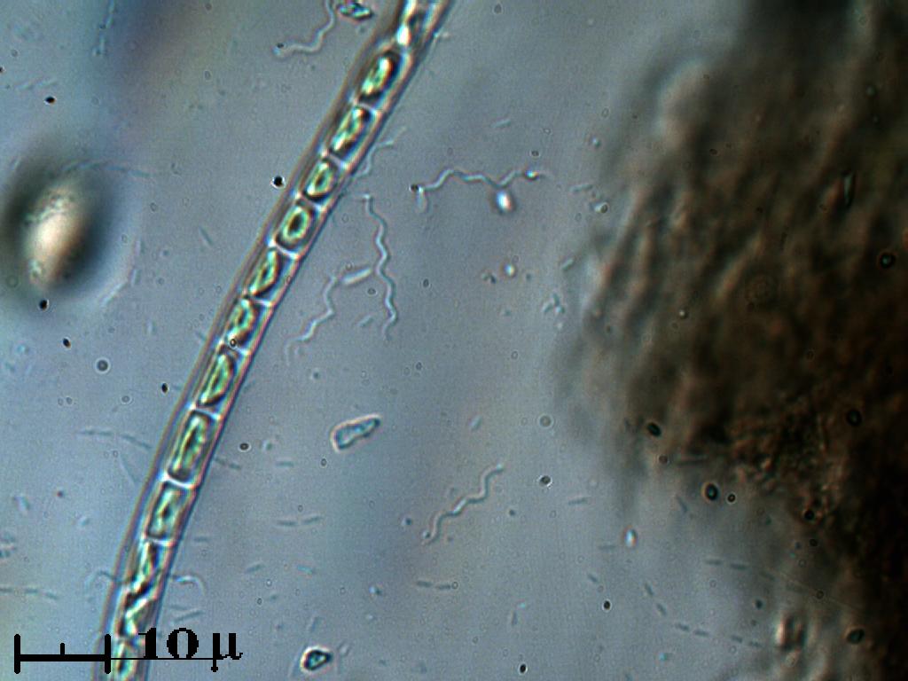 Spirochete