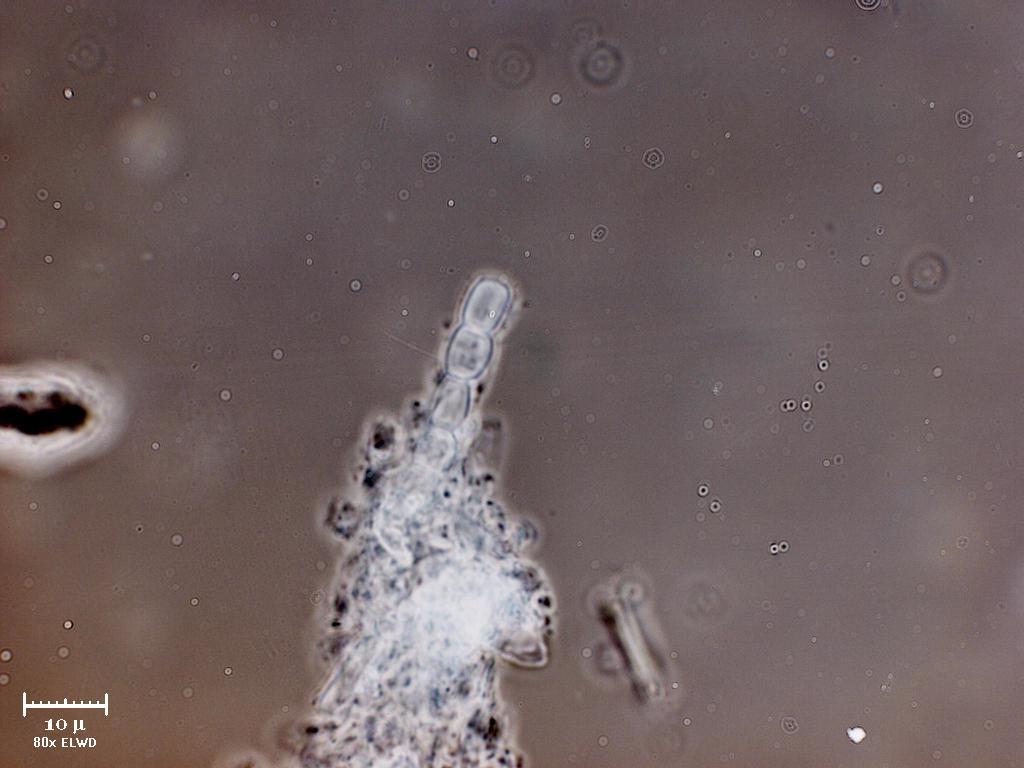 Spore (65%) cyanobatteri (30%) polline (4,9%) Ameba (0,1%)