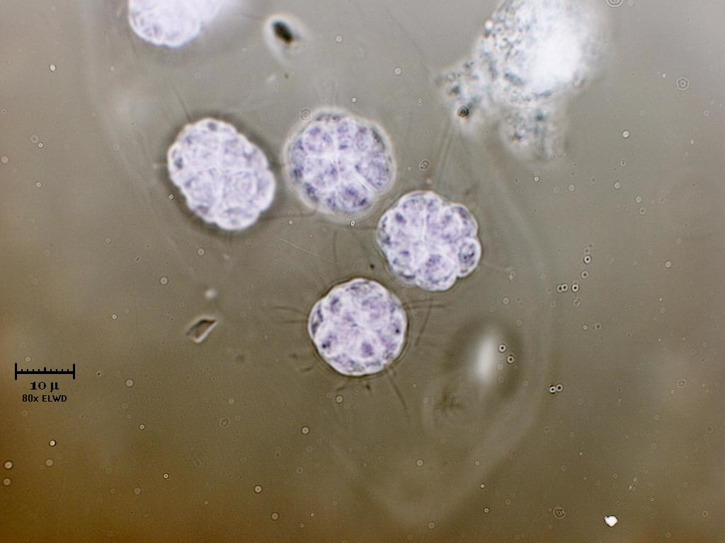 N U O V A !  Eudorina.