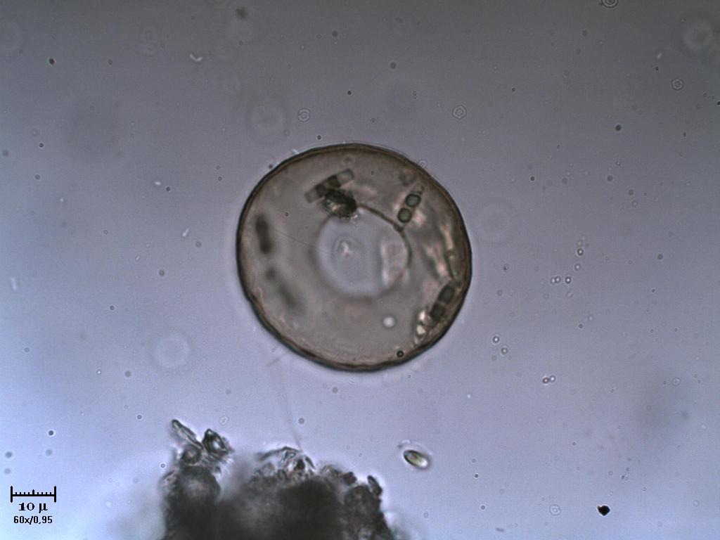 Tecameba [ Arcella sp. ]