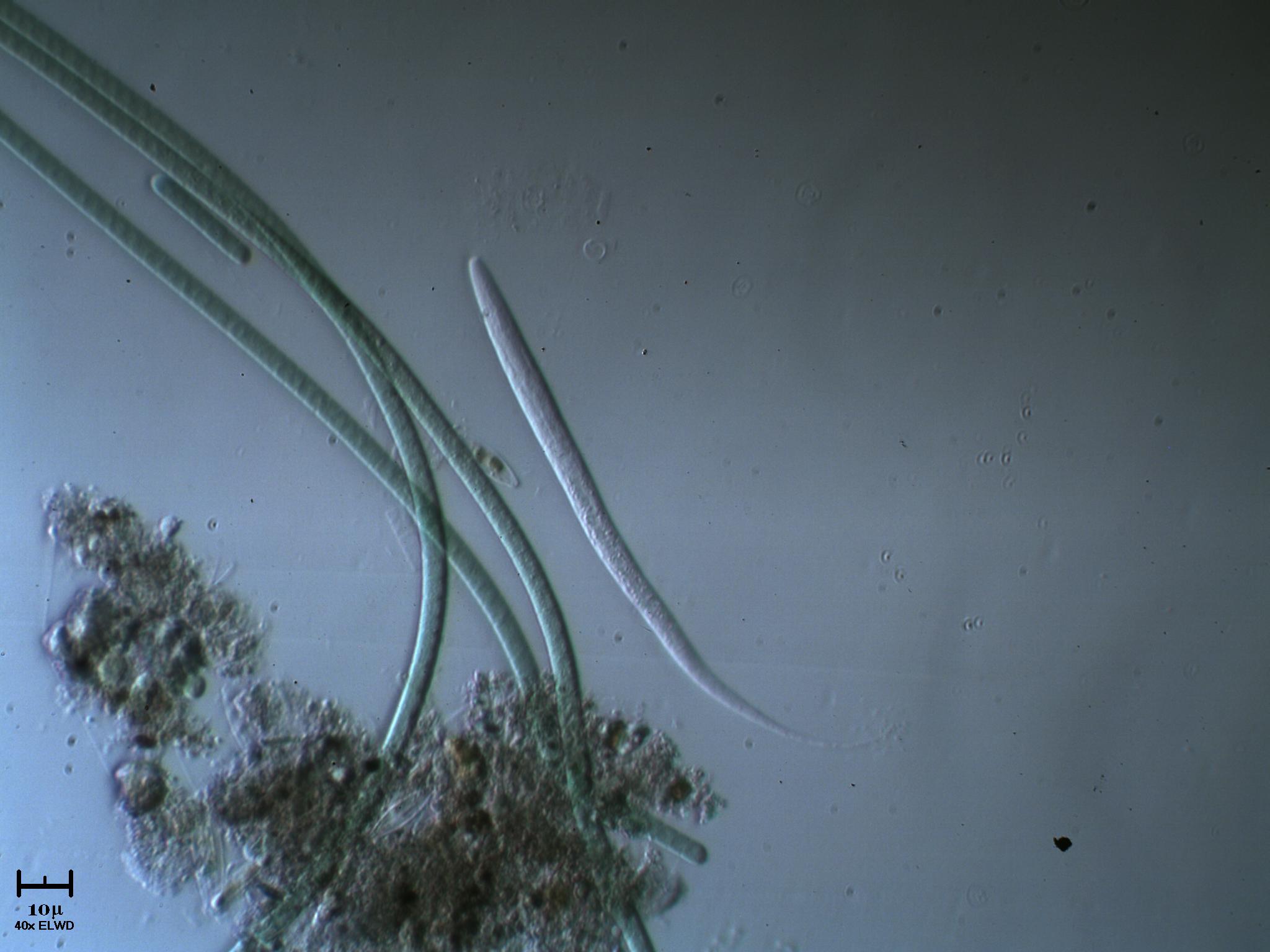 Nematode & Cianoficee