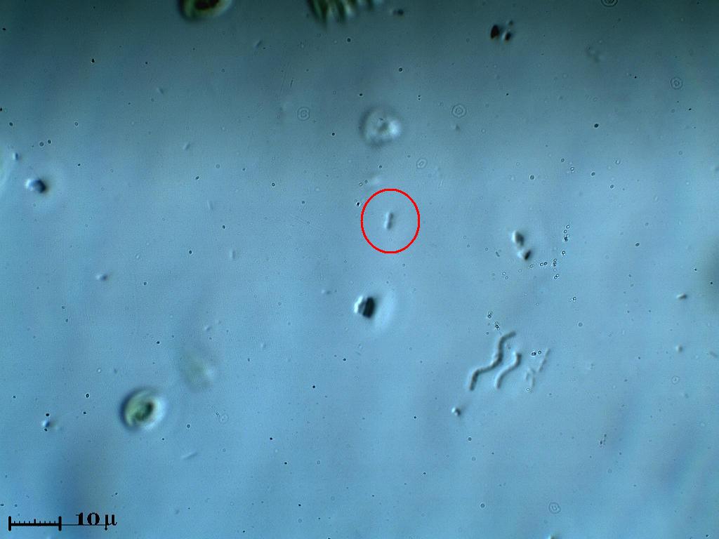 Microbatteri