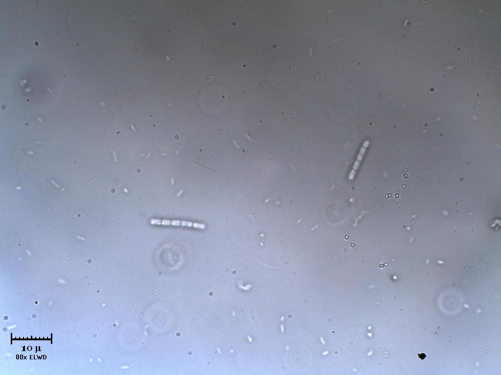 Cianobatteri