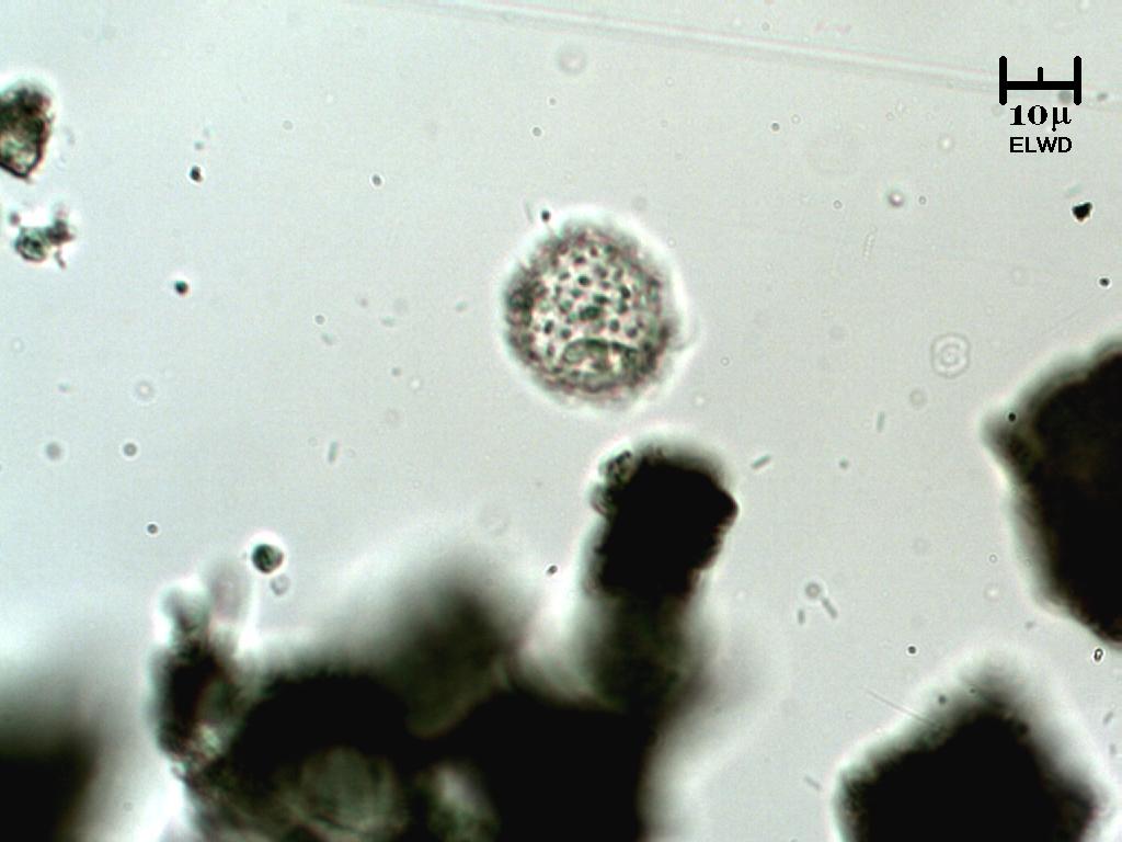 Virus A H1N1