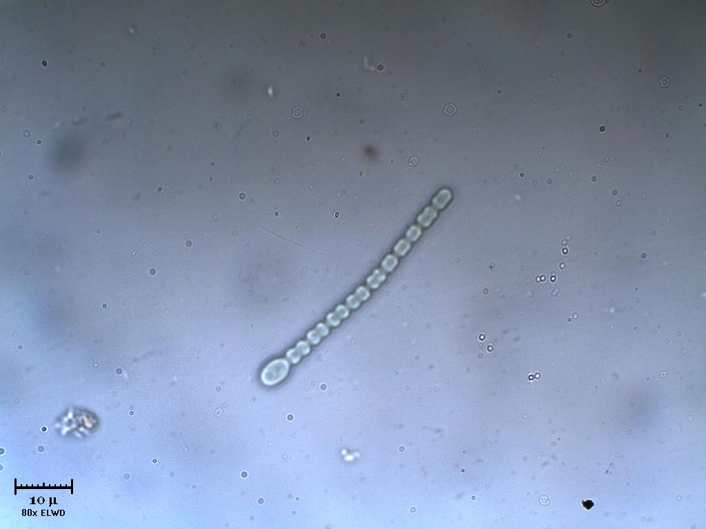 Cianobatteri