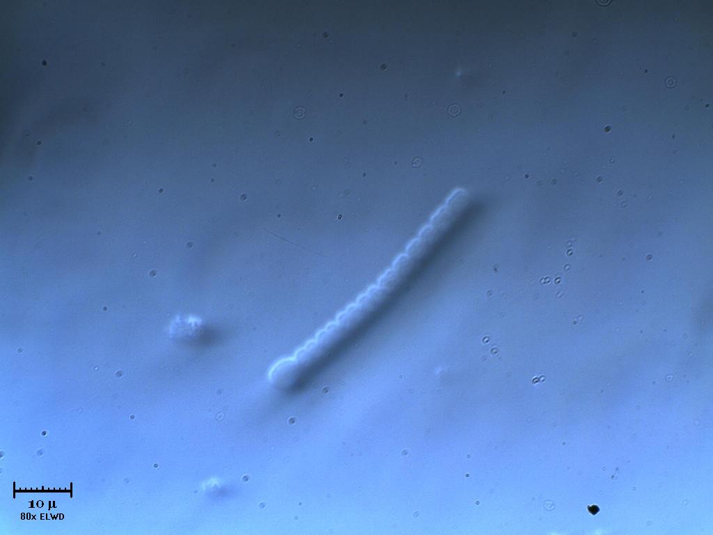 Cianobatteri