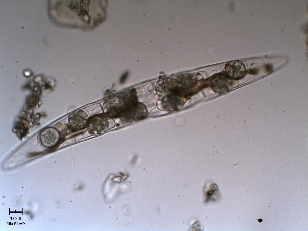 Cosa  successo a questo Closterium?